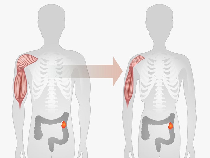 Đột ngột giảm cân - tiềm ẩn nhiều nguy cơ với sức khỏe - 1