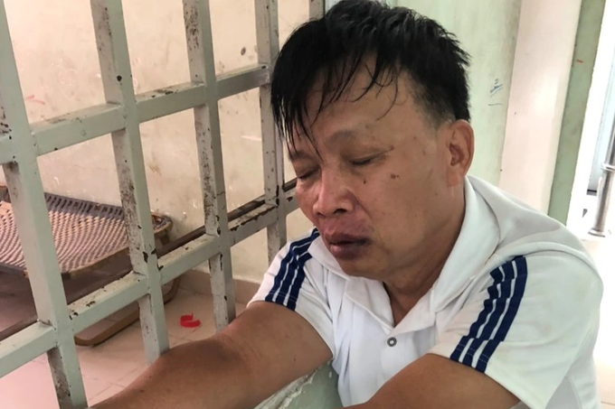 Đi xe ôm, thiếu nữ 18 tuổi bị gã đàn ông trói vào gốc cây rồi hiếp dâm - 2