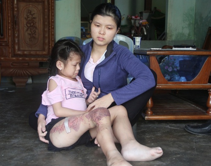 Little girl struggles to survive against cancer - 1 Little girl struggles to survive against cancer - 1