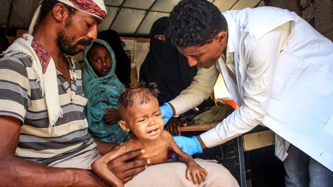 Famine conditions in war-torn Yemen rising sharply: UN - 1