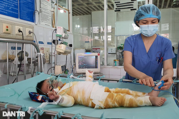 Dantri/DTiNews readers support seriously-burnt boy in Bac Giang - 1