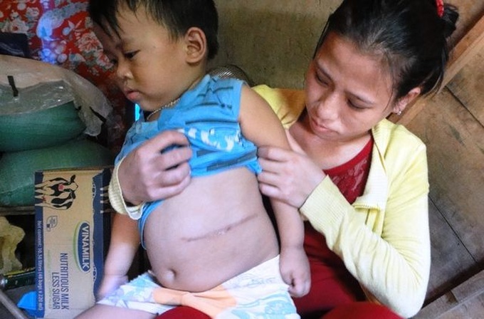 Little boy battling kidney problems needs help - 1