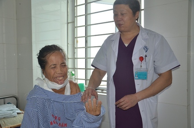 Woman suffering from horrific facial burns has life-transforming operation - 3