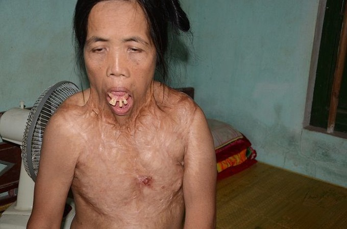 Woman with facial deformity calls for help - 1