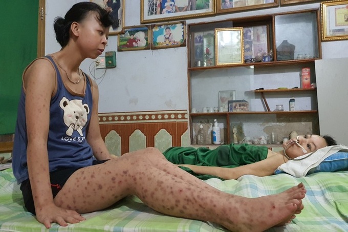 Family struggling with heart diseases call for help - 2 Family struggling with heart diseases call for help - 2