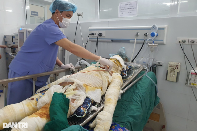 Seriously-burnt man in desperate need of support - 1