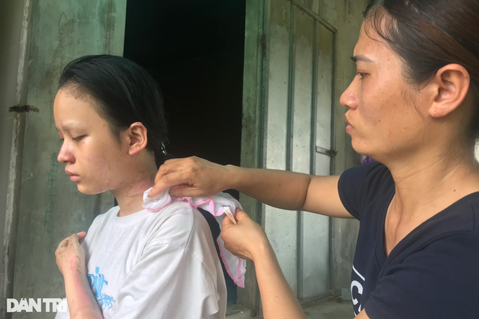 Ailing family in Nghe An calls for help - 1