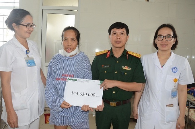 Woman suffering from horrific facial burns has life-transforming operation - 4