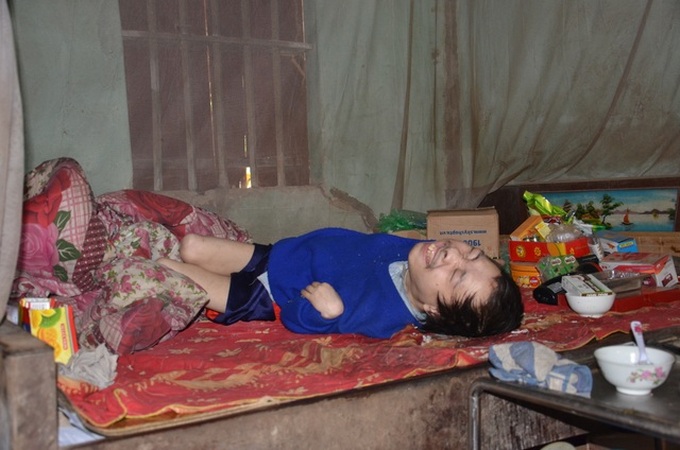 Old mother struggles to raise cerebral palsy son - 2