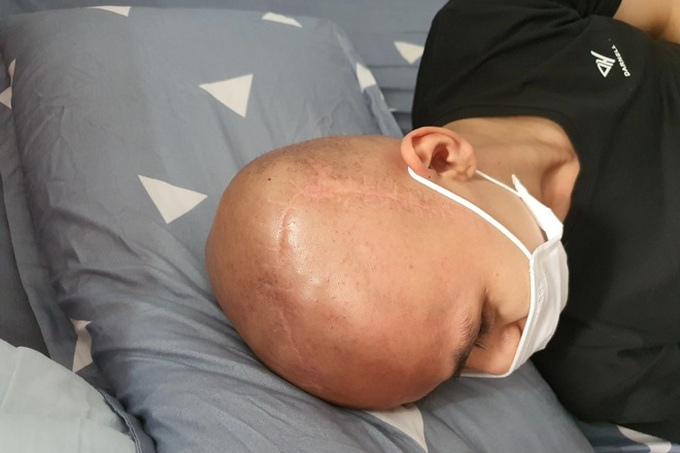 Readers support poor young man in cancer fight - 2