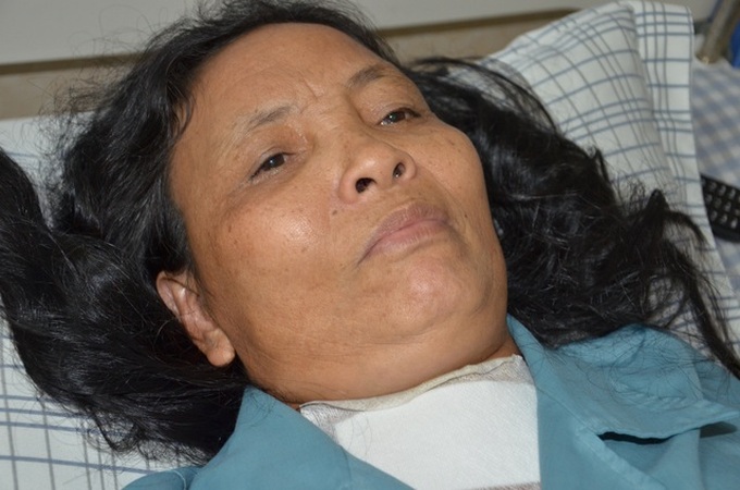 Helpless woman in need of support to fight two cancers - 1 Helpless woman in need of support to fight two cancers - 1