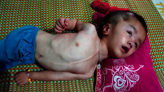 Mother struggles to provide daily meals to small children - 1