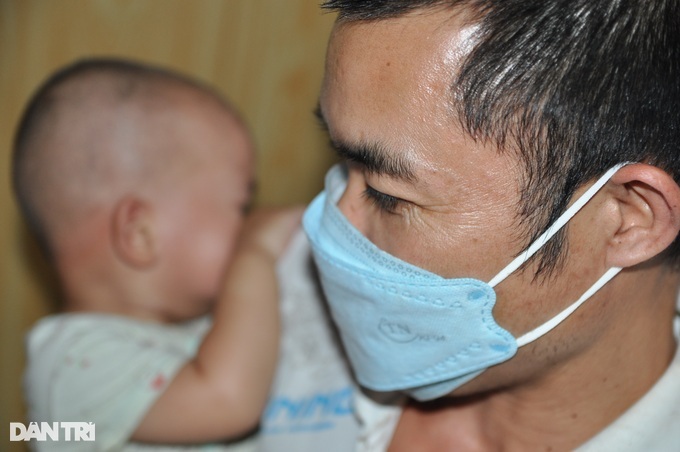 Poor ethnic minority couple call for help to save daughter from retinoblastoma - 2