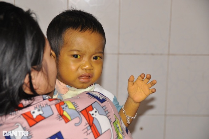 Little boy struggling with biliary atresia needs help - 2