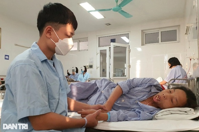 Woman seeks supports to treat serious burns - 2