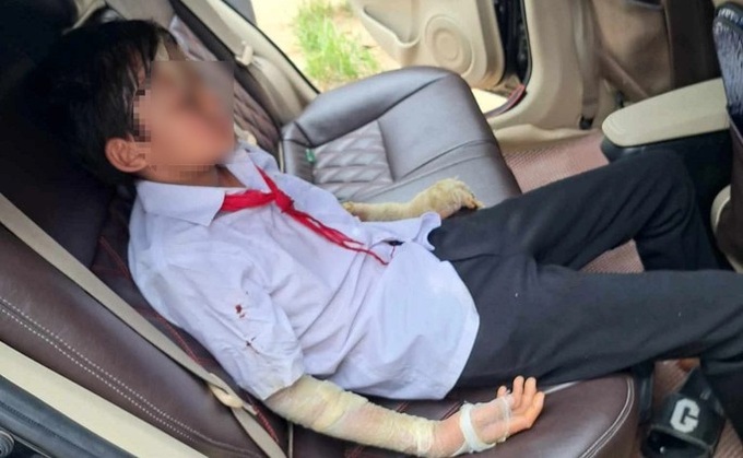 Balloon explosion injures seven students in Thanh Hoa - 1
