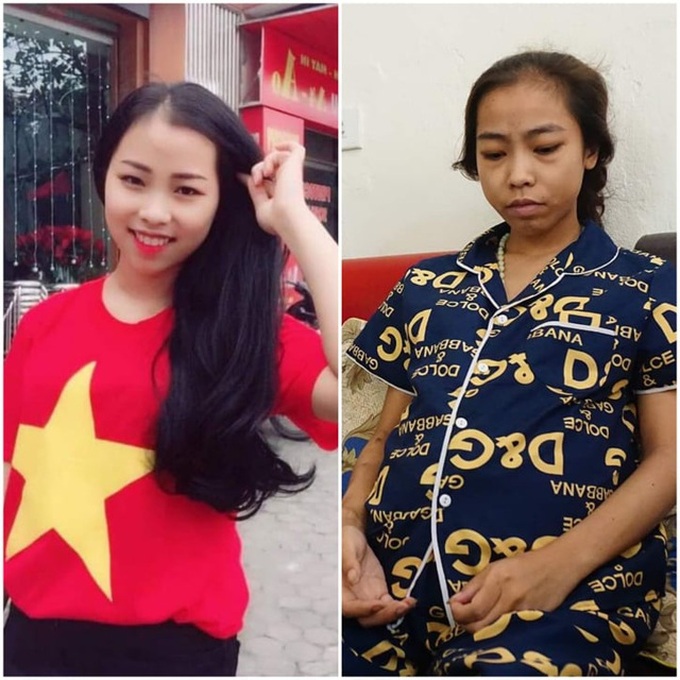 Young woman struggling with serious diseases needs help - 1 Young woman struggling with serious diseases needs help - 1