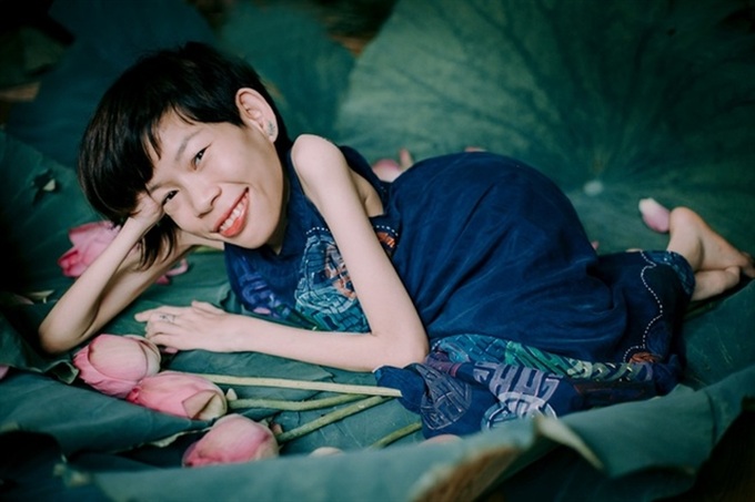 Photographer showcases beauty of the disabled - 1 Photographer showcases beauty of the disabled - 1