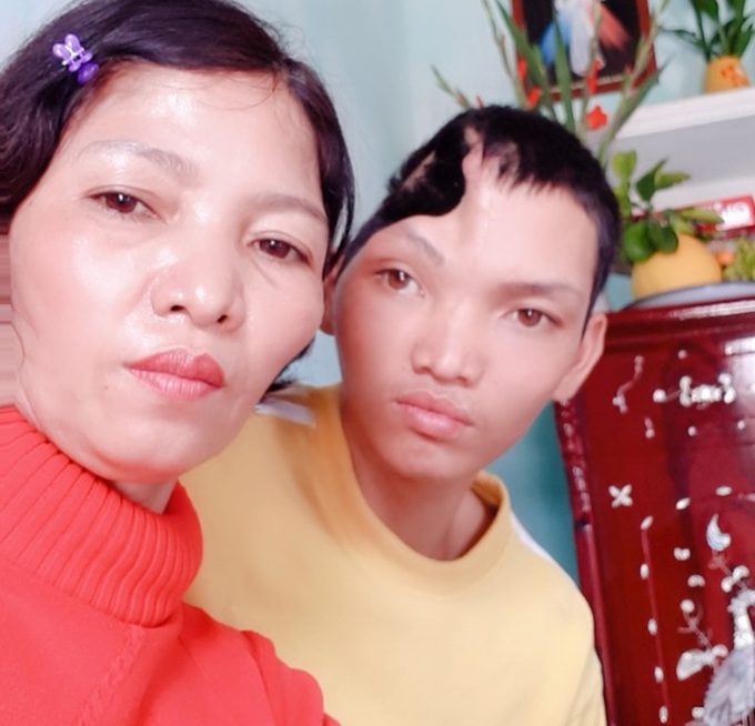 Poor man to get surgery thanks to support - 2