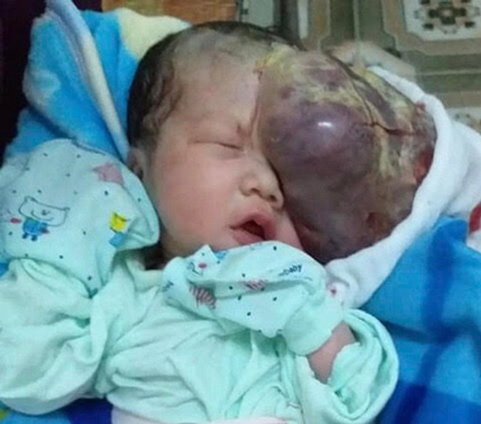 Woman seeks help for newborn baby with abnormal face - 1 Woman seeks help for newborn baby with abnormal face - 1