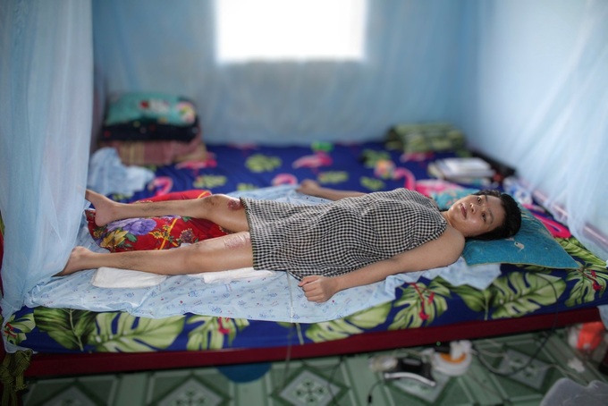 Young woman needs support to recover from serious injury - 1