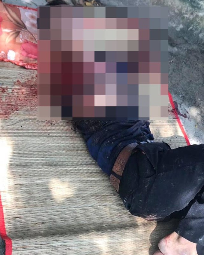 Man loses arm in tiger attack - 1