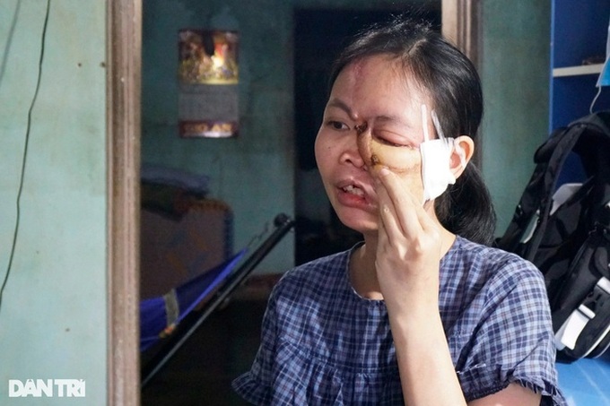 Woman with distorted face in Binh Dinh needs help - 1