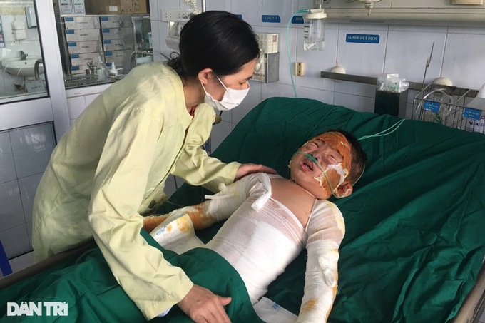 Boy suffering serious burns gets support - 1