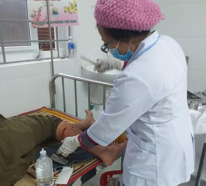 Langur attacks man in Quang Tri - 1