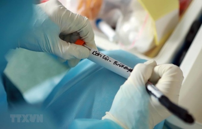 About 30 labs in Vietnam capable of testing for COVID-19 - 1