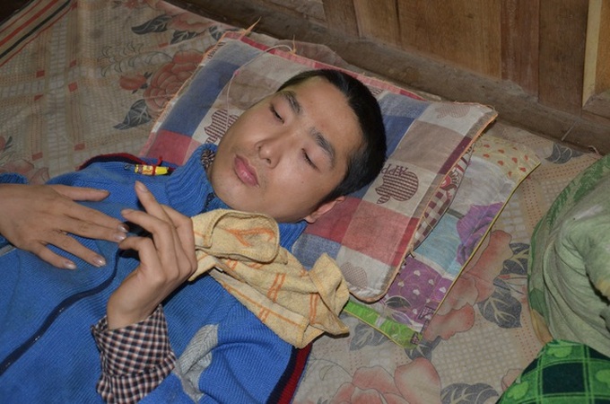 Tay ethnic man calls for help to treat tuberculosis - 1 Tay ethnic man calls for help to treat tuberculosis - 1