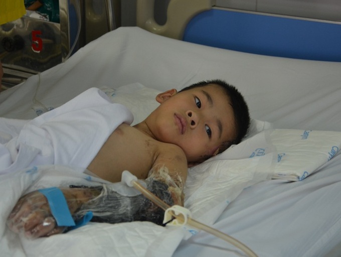 Six-year-old boy could lose limb after traffic accident - 1 Six-year-old boy could lose limb after traffic accident - 1