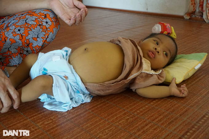 Poor mother seeks help to save ailing little daughter - 1