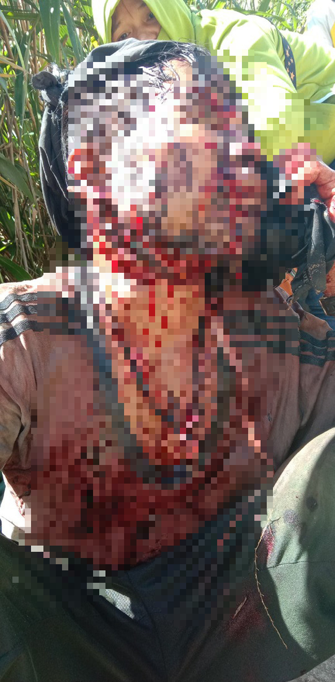 Quang Nam man in critical condition following bear attack - 1