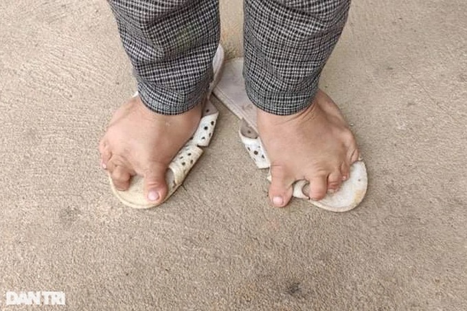 Little girl facing big tumours in dire need of support - 3