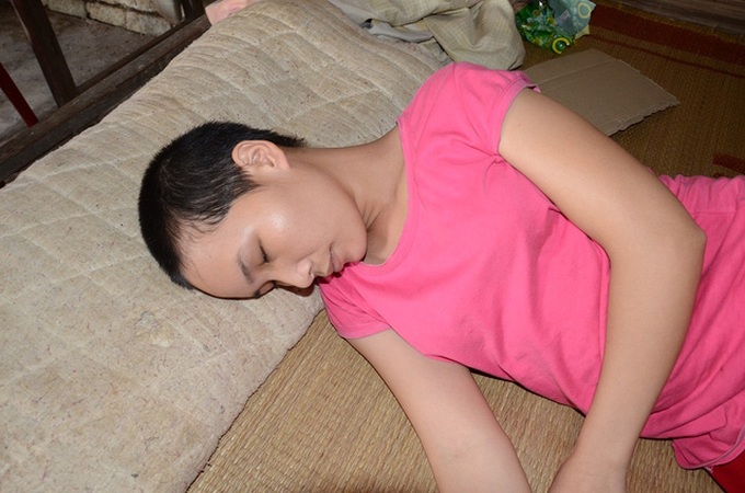 Poor woman needs urgent help after workplace accident - 1