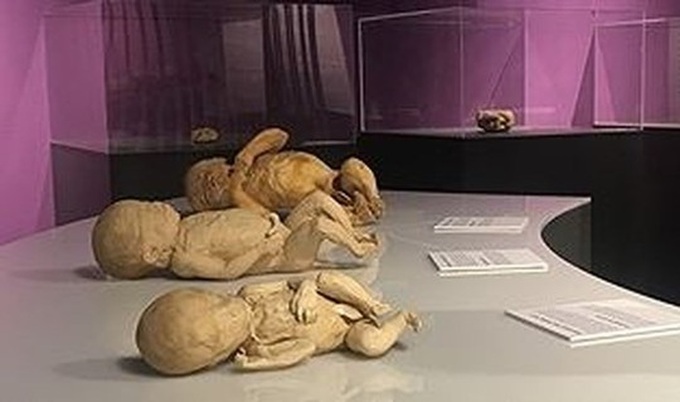 Mystery of the Human Body exhibition halted - 2