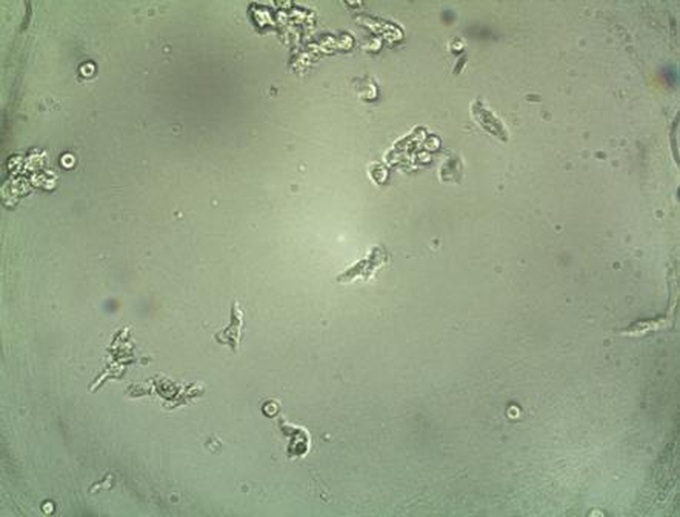 Second fatality from brain-eating amoeba - 1