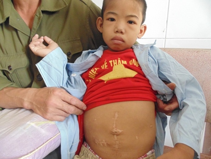 Poor boy struggling with rising kidney problems - 2 Poor boy struggling with rising kidney problems - 2