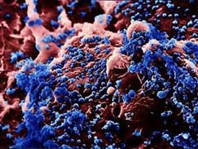 A/H5N1 virus mutates against vaccines - 1