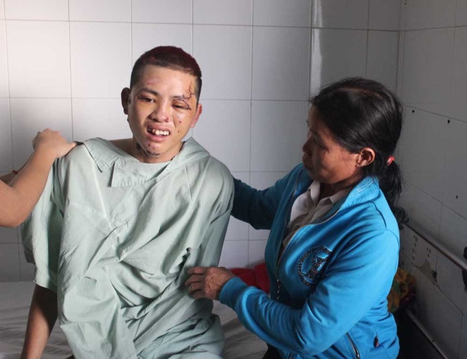 Mother calls for help for injured son - 2