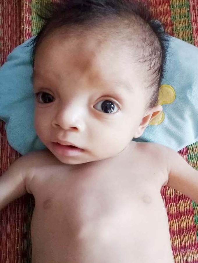 Family calls for help for ill infant - 2 Family calls for help for ill infant - 2