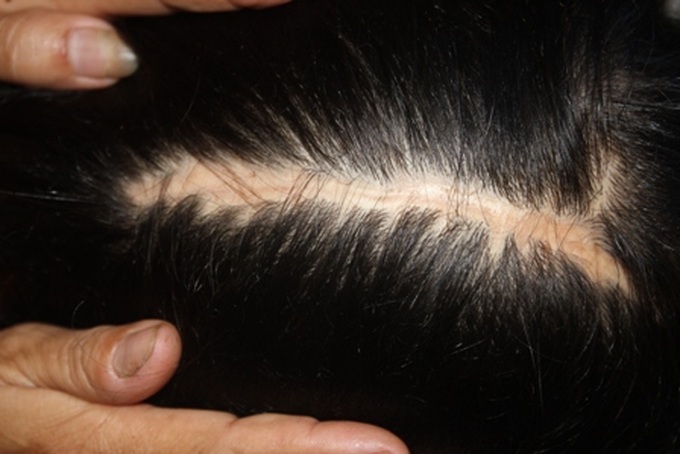 Little girl is facing death after numerous surgeries - 2