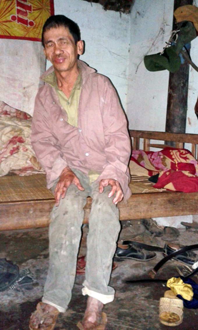 Poor, ailing man wishes for a decent meal - 1