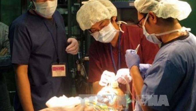 Japanese doctors offer free surgery to children with cleft lips, palates - 1 Japanese doctors offer free surgery to children with cleft lips, palates - 1