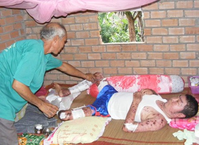 Young man with thrombocytopenia hoping in vain for survival - 1 Young man with thrombocytopenia hoping in vain for survival - 1