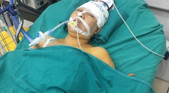 Husband and wife in critical condition after separate accidents - 1 Husband and wife in critical condition after separate accidents - 1