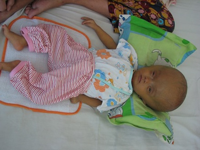 Little boy struggles with serious diseases - 1 Little boy struggles with serious diseases - 1