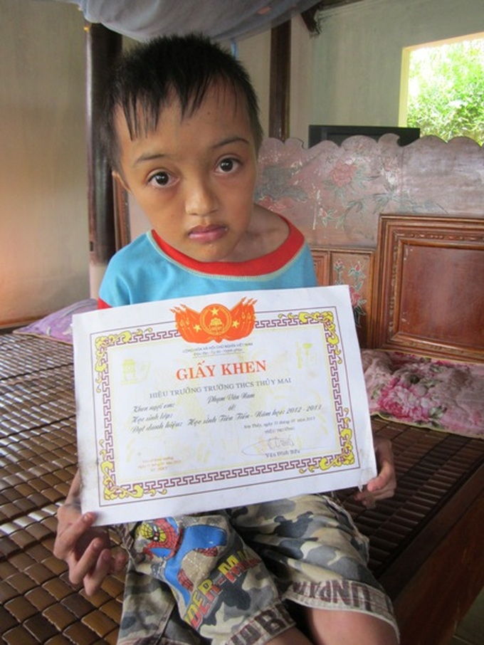 Brittle-bone boy faces life with strength - 1