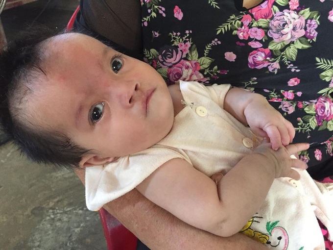 Little girl struggling with serious diseases - 2